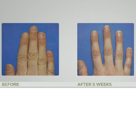 T.I.P.S. Nail Strengthening Conditioner Duo Auto-Delivery — View 4