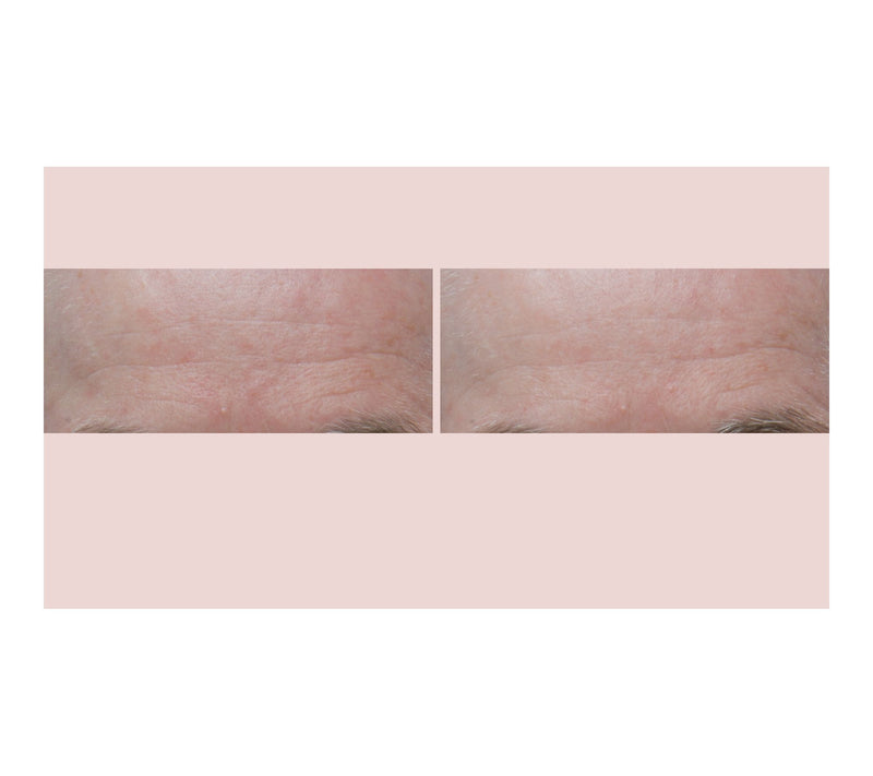Dr. Denese Super-Size Essential Day and Night Duo — View 5