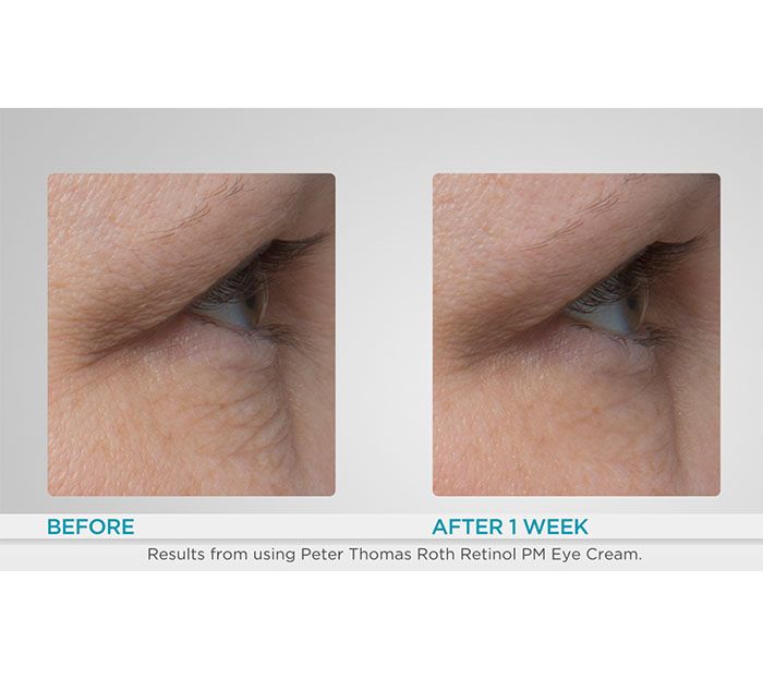 Peter Thomas Roth Super-Size Retinol Fusion Eye Cream — View 5