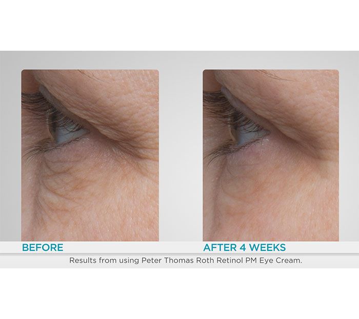 Peter Thomas Roth Super-Size Retinol Eye Auto-Delivery — View 3