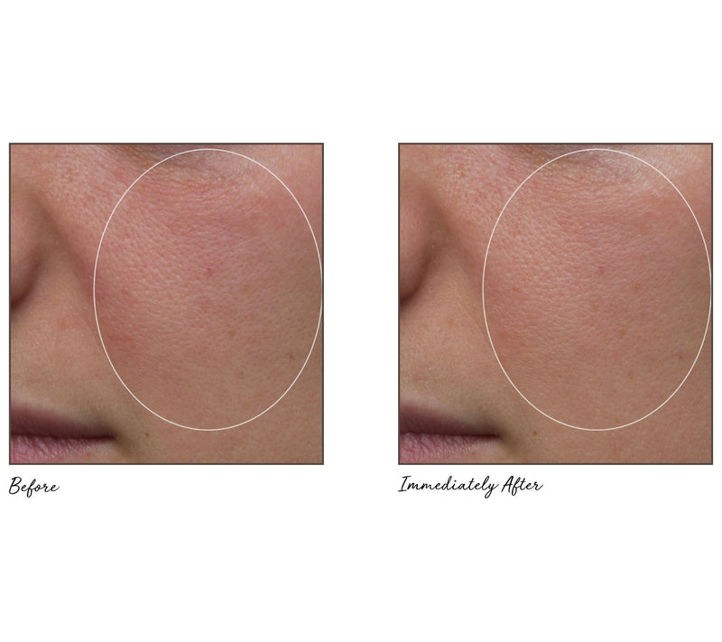 Peter Thomas Roth Pumpkin Enzyme Mask — View 6