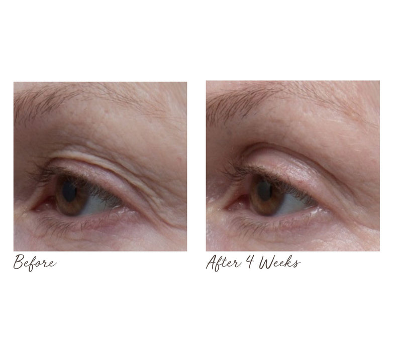 ELEMIS Peptide4 Eye Recovery Cream Oil — View 6