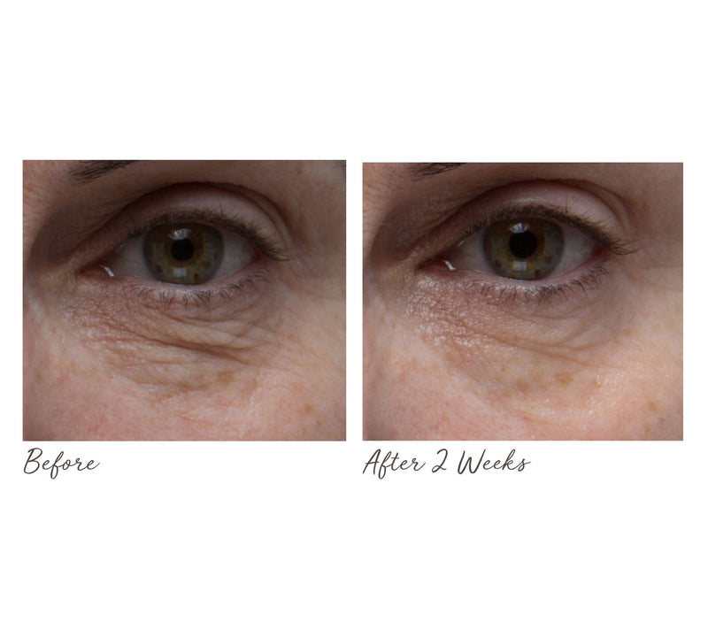 ELEMIS Peptide4 Eye Recovery Cream Oil — View 5