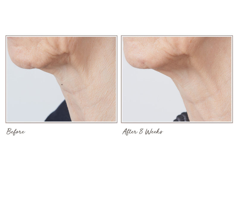 Perricone MD Cold Plasma+ Sub-D Neck Treatment 2oz — View 6
