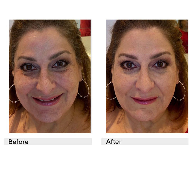 Laura Geller Balance-N- Brighten Foundation Duo w/ Brush — View 20
