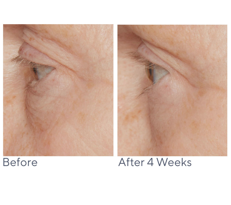 Lancer Active Rejuvenation Serum w/ Triple Dermal Complex — View 8