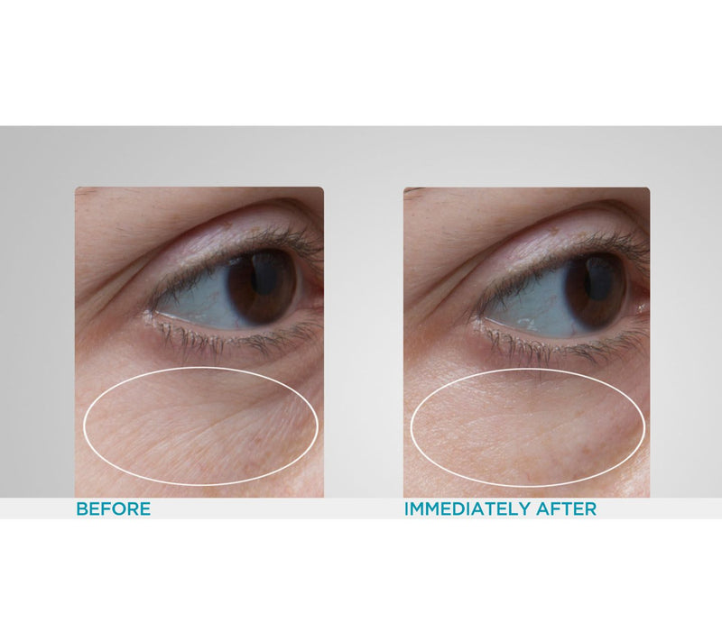 Peter Thomas Roth Hydra-Gel 24K Gold Eye Patches — View 3