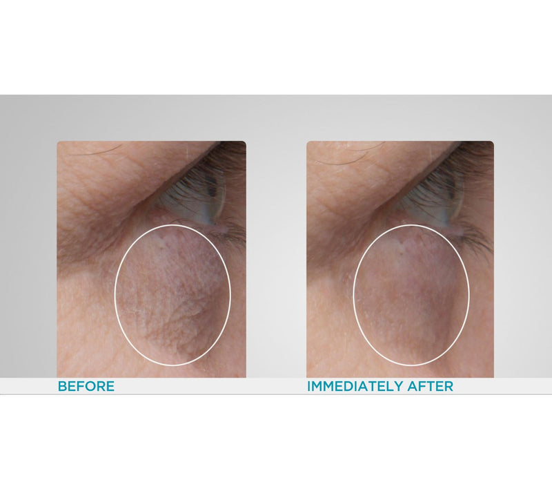 Peter Thomas Roth Hydra-Gel 24K Gold Eye Patches — View 6