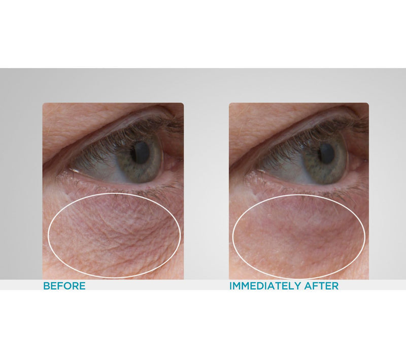 Peter Thomas Roth Hydra-Gel 24K Gold Eye Patches — View 5