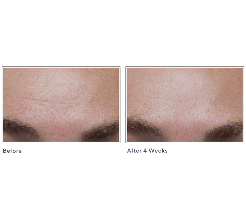 Peter Thomas Roth Potent-C Power Serum — View 7