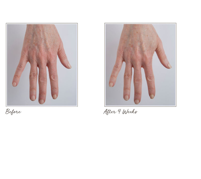 Perricone MD Cold Plasma  Hand Therapy — View 4