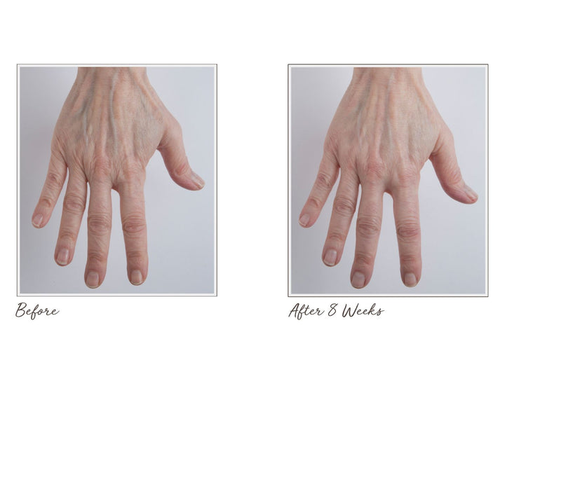 Perricone MD Cold Plasma  Hand Therapy — View 6