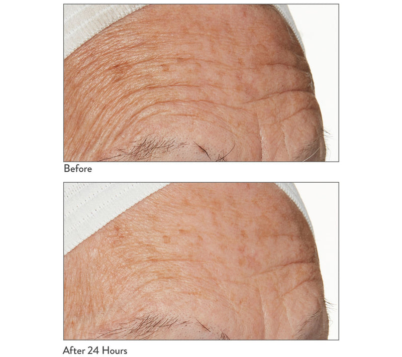 Lancer Instant Contour Firming Facial Treatment — View 2
