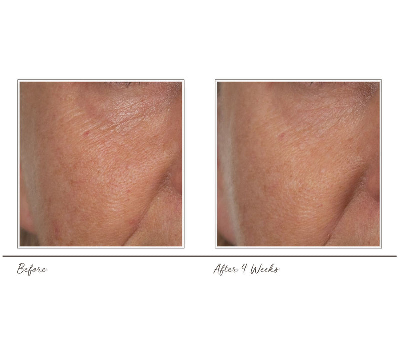 Lancer Caviar Lime Acid Peel 1.7-oz Duo — View 3