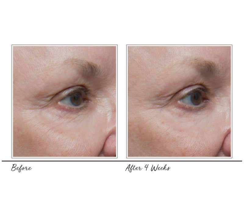 MicrodermMD by Trophy Skin Microderm- abrasion System — View 12