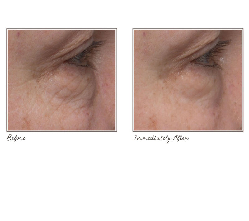 ELEMIS Ultra Smart Anti-Aging Eye Treatment AM and PM Duo — View 8