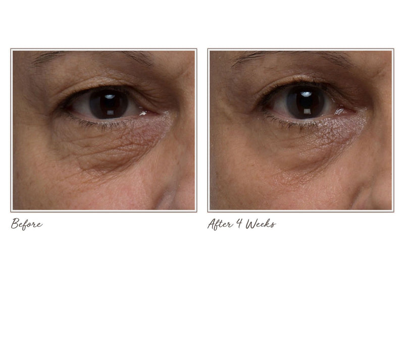 ELEMIS Ultra Smart Anti-Aging Eye Treatment AM and PM Duo — View 7
