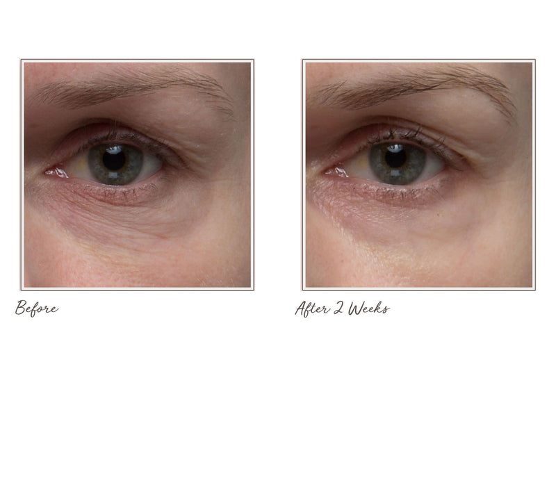 ELEMIS Ultra Smart Anti-Aging Eye Treatment AM and PM Duo — View 5