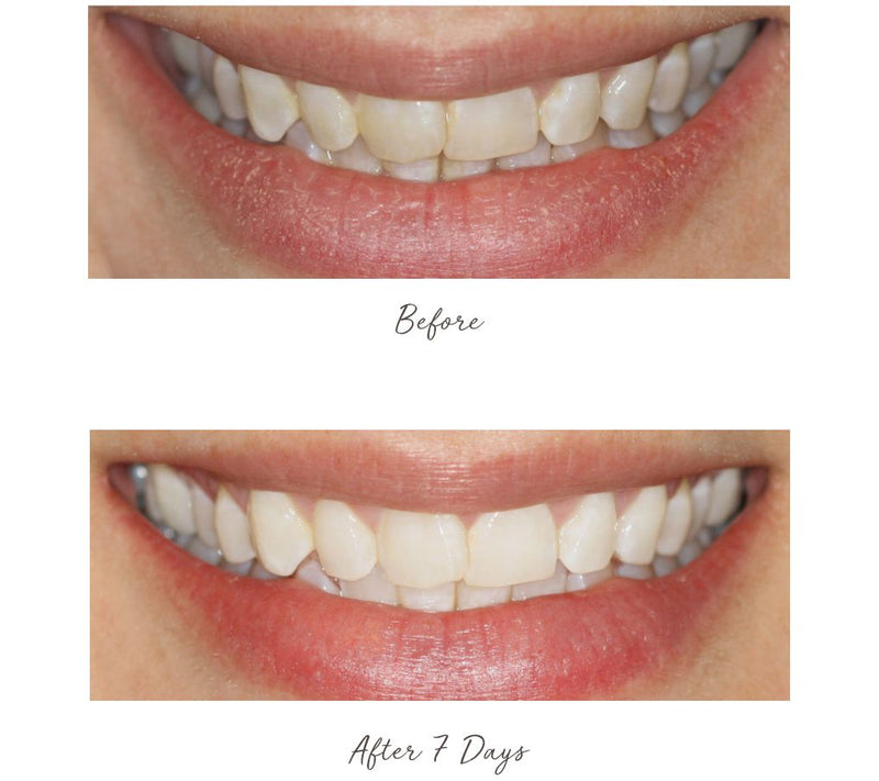 Smileactives Advanced Whitening Pens Duo — View 6
