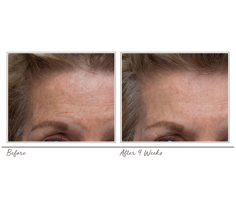 ELEMIS Pro-Collagen Marine Cream & Anti-Aging Renewal Serum — View 6