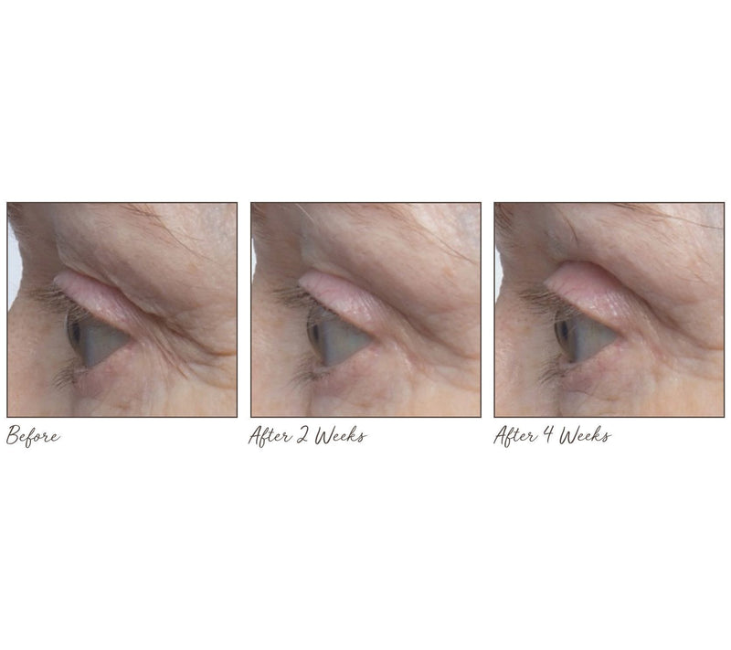 ELEMIS Pro-Collagen Marine Cream & Anti-Aging Renewal Serum — View 7