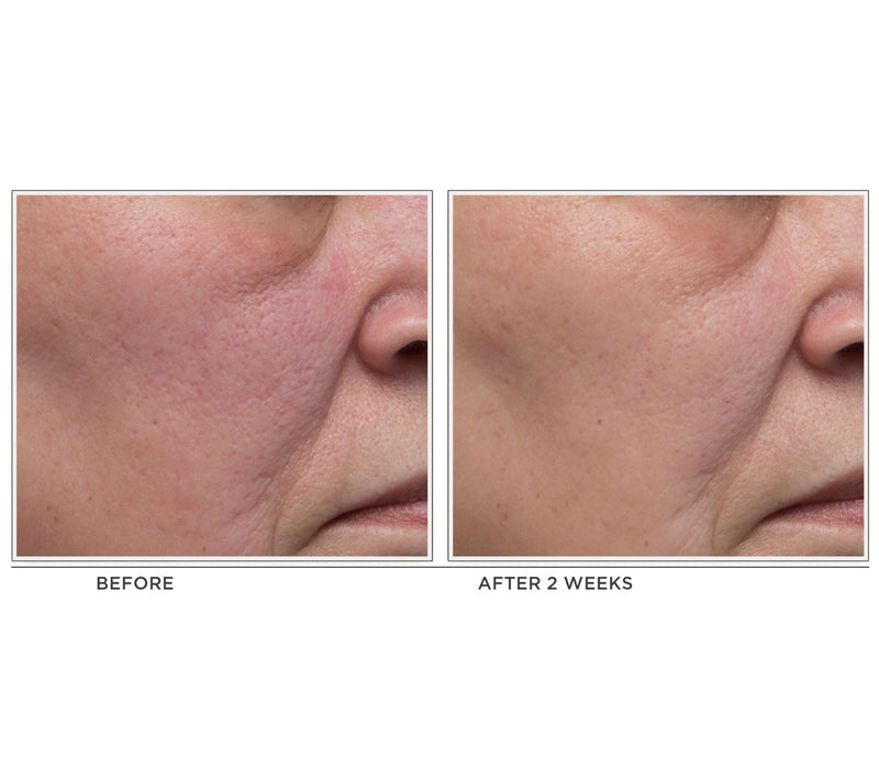 ELEMIS Dynamic Resurfacing Facial Pads Duo Auto-Delivery — View 7