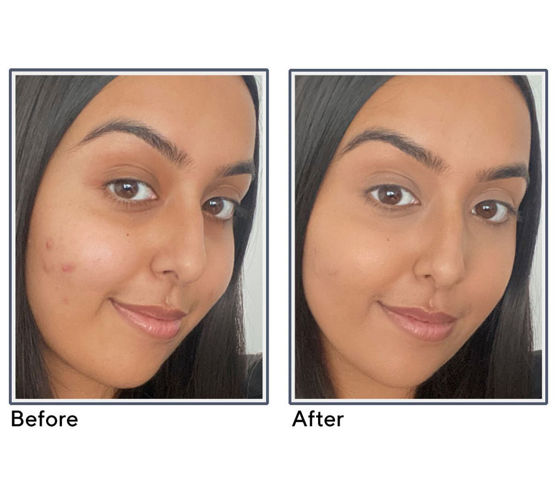 Doll 10 Doll Skin Anti- Stress Skin Perfecting Concealer — View 28