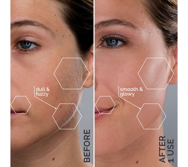 Michael Todd Beauty Sonic Dermaplaning Peach Fuzz Removal — View 11