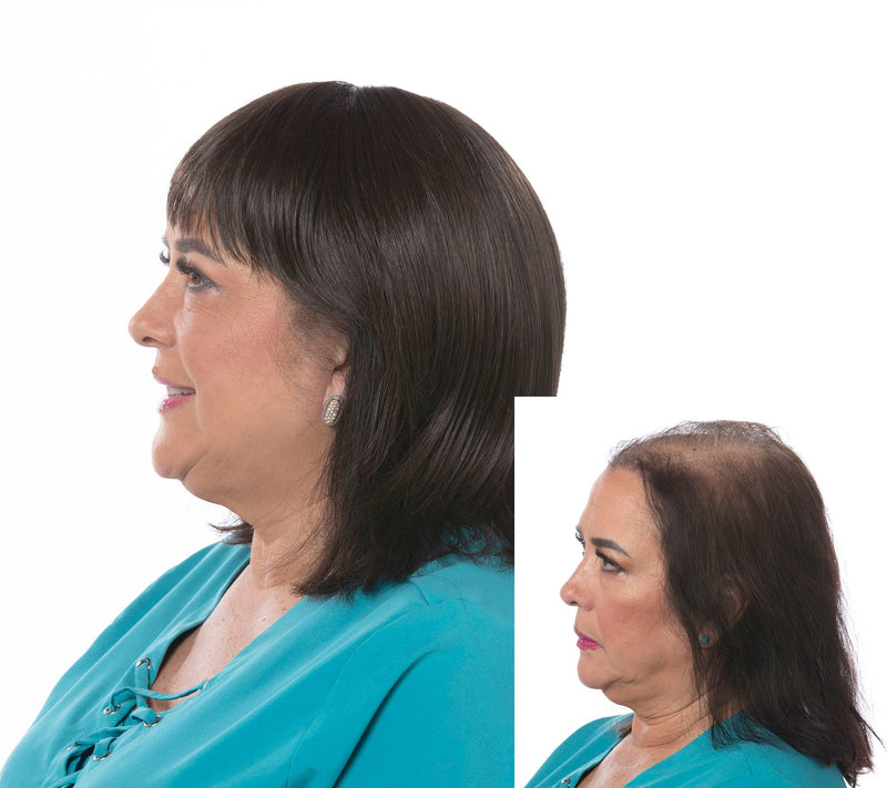 Toni Brattin Complete Coverage Total Topper Hairpiece — View 31