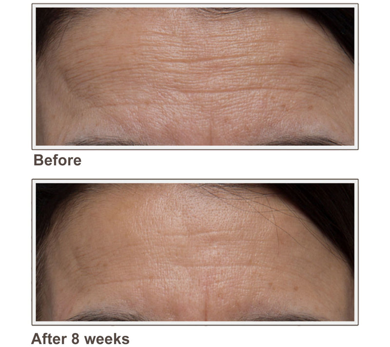 ELEMIS Pro-Collagen Skin Future Supplements — View 7