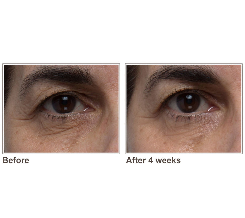 ELEMIS Pro-Collagen Skin Future Supplements — View 5