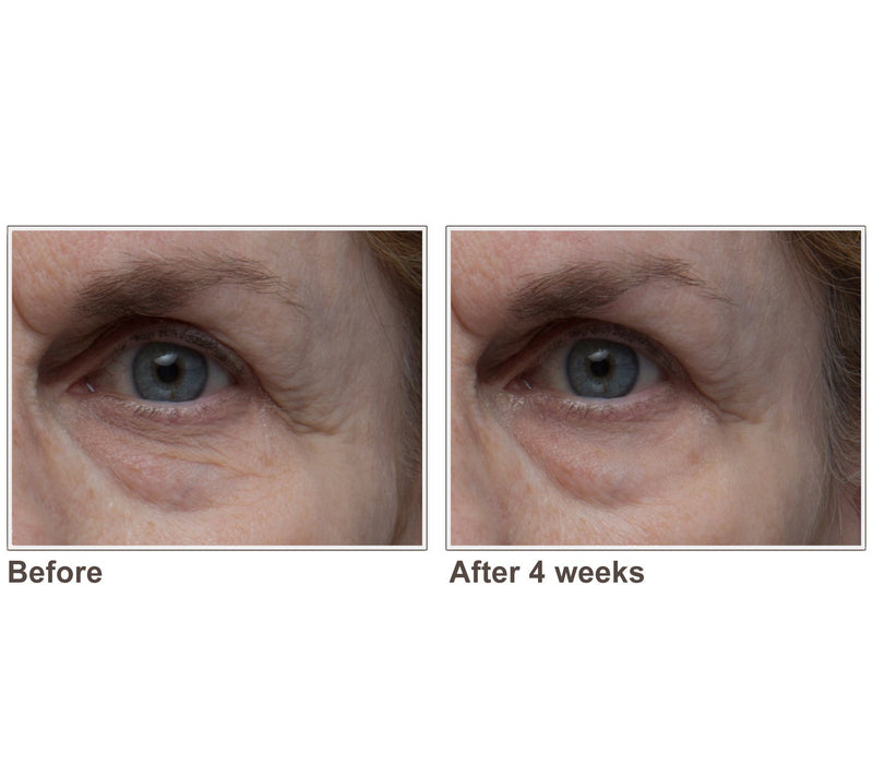 ELEMIS Pro-Collagen Skin Future Supplements — View 6