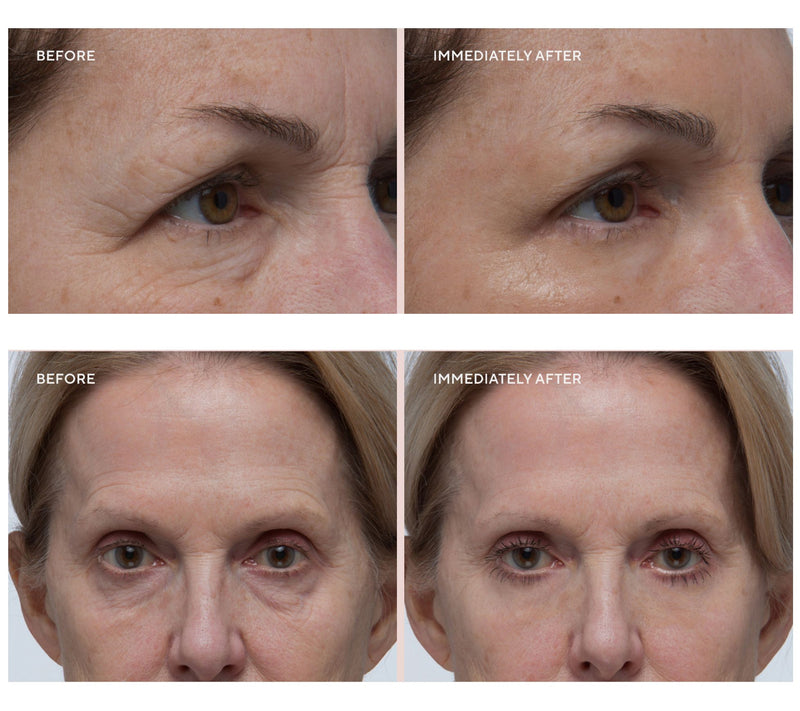 Westmore Beauty 60 Second Eye Effects Gel Duo Auto-Delivery — View 6
