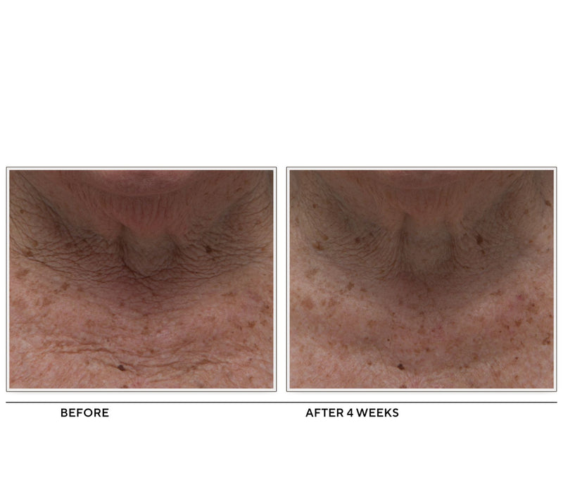 PeterThomasRoth Super-Size Un-Crepe Face & Neck Moisturizer — View 5