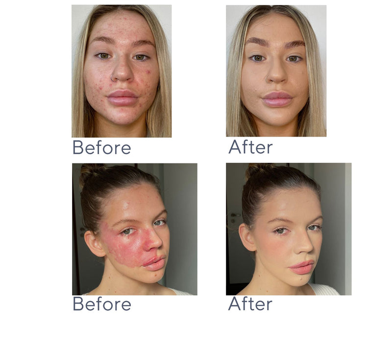 Doll 10 T.C.E. Super Coverage Serum Foundation — View 24