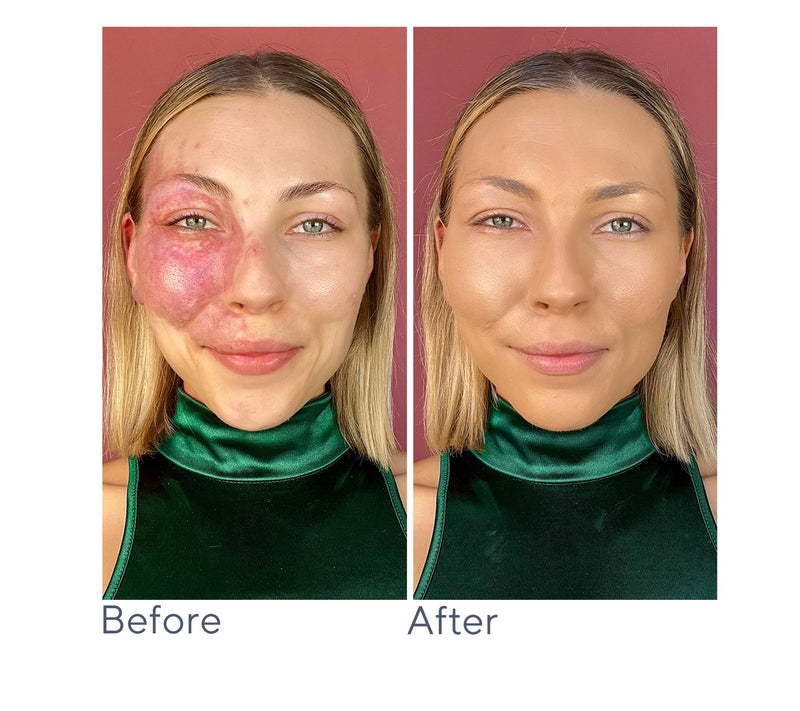Doll 10 T.C.E. Super Coverage Serum Foundation — View 25