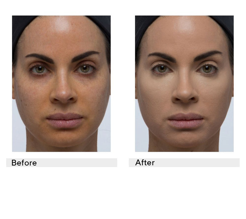 Doll 10 T.C.E. Super Coverage Treatment Concealer — View 25