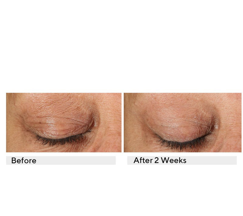 KAPLAN MD Diamond Contour Ultimate Hydration Eye Serum Duo — View 7