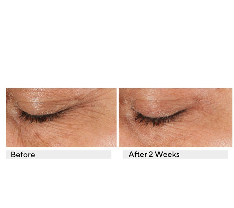 KAPLAN MD Diamond Contour Ultimate Hydration Eye Serum Duo — View 6