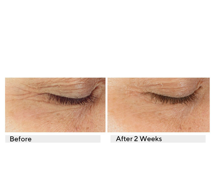 KAPLAN MD Diamond Contour Ultimate Hydration Eye Serum Duo — View 4