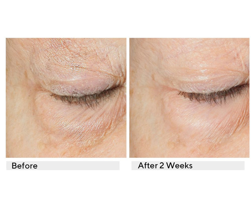 KAPLAN MD Diamond Contour Ultimate Hydration Eye Serum Duo — View 5
