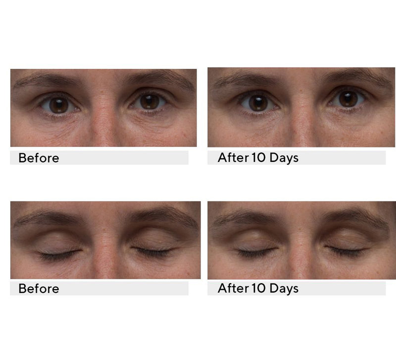Algenist Triple Algae Eye Renewal Balm Duo with Applicator — View 5