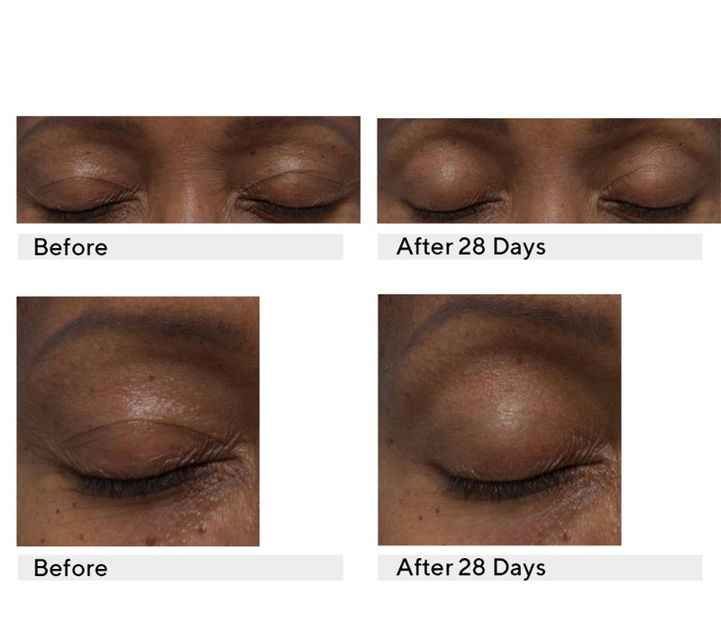 Algenist Triple Algae Eye Renewal Balm Duo with Applicator — View 6