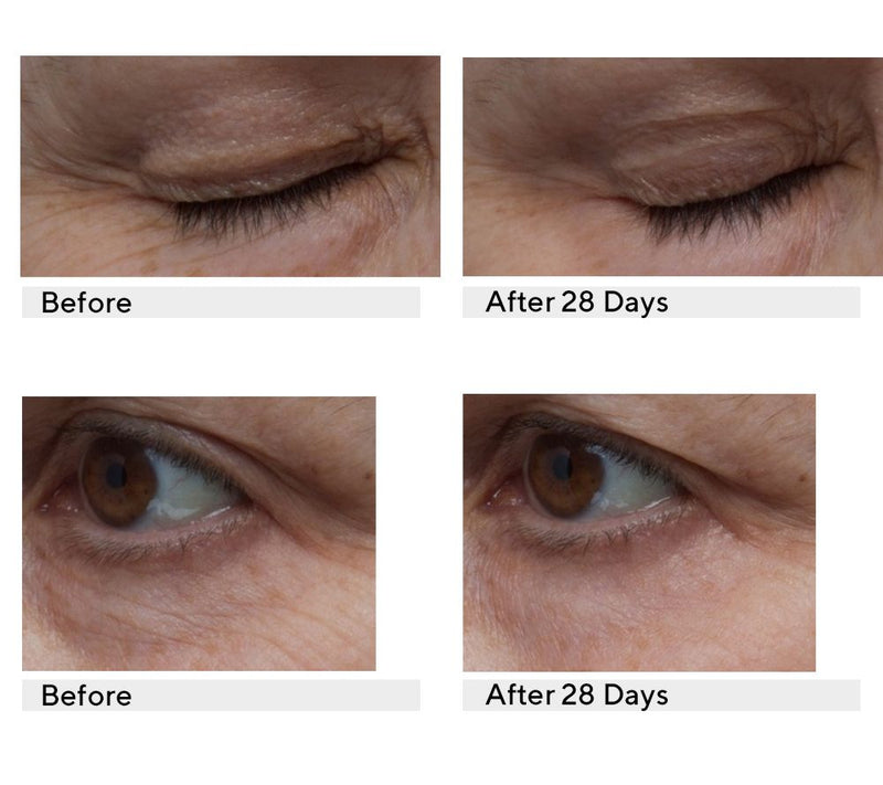 Algenist Triple Algae Eye Renewal Balm Duo with Applicator — View 7