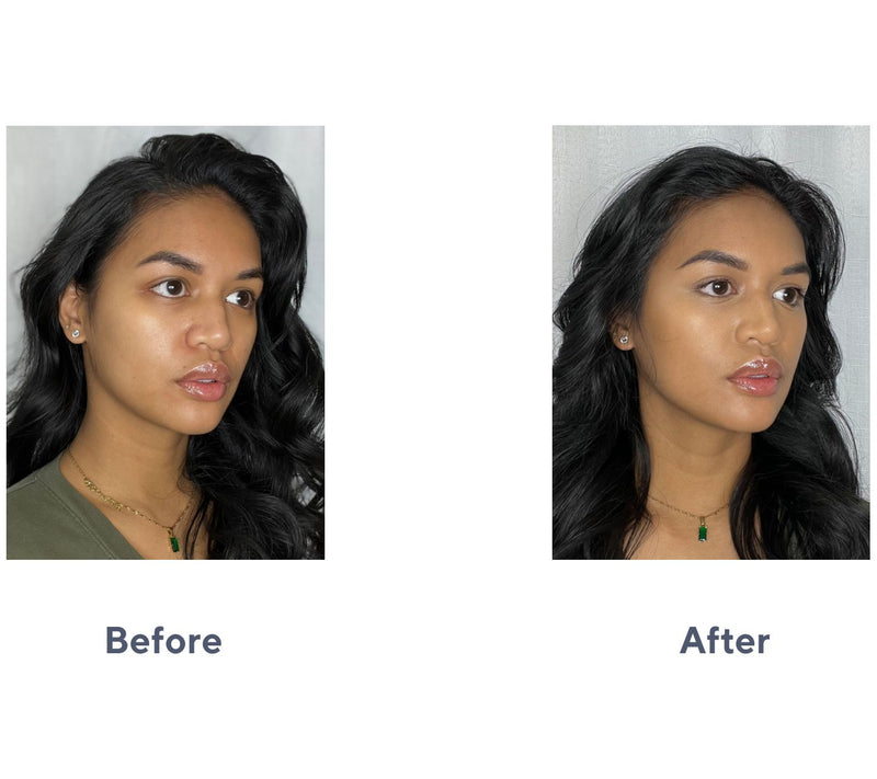 Doll 10 Doll Skin Genius Tinted Under Eye Treat ment — View 15