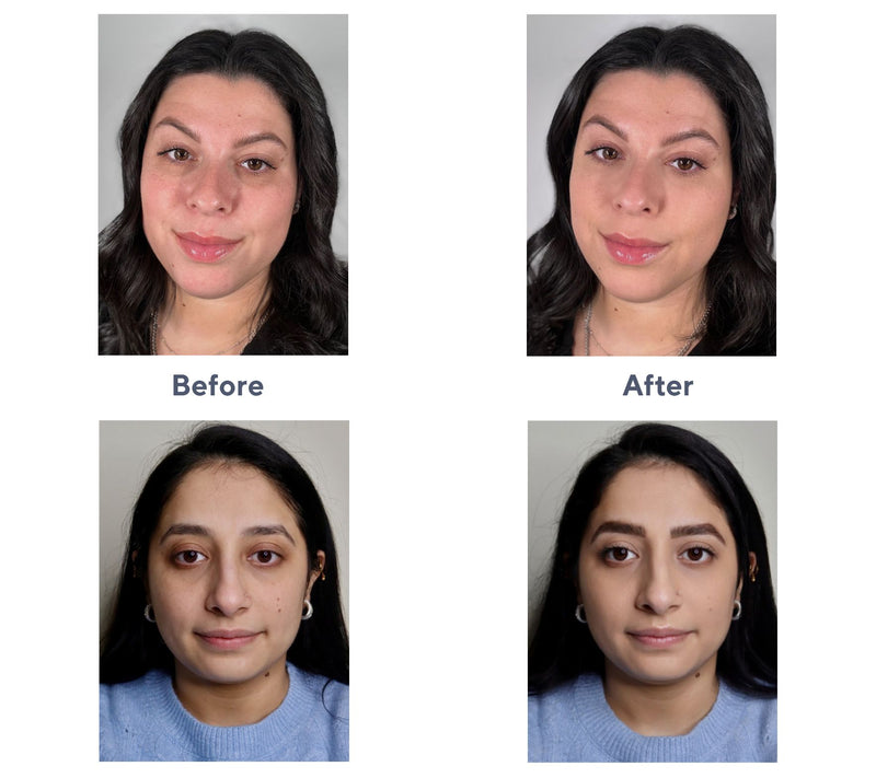 Doll 10 Doll Skin Genius Tinted Under Eye Treat ment — View 18