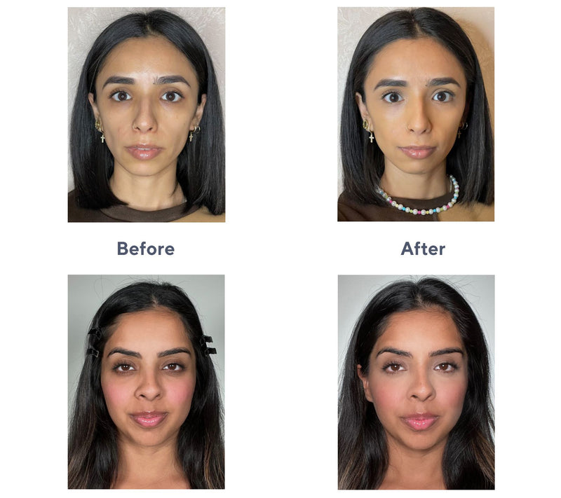 Doll 10 Doll Skin Genius Tinted Under Eye Treat ment — View 16