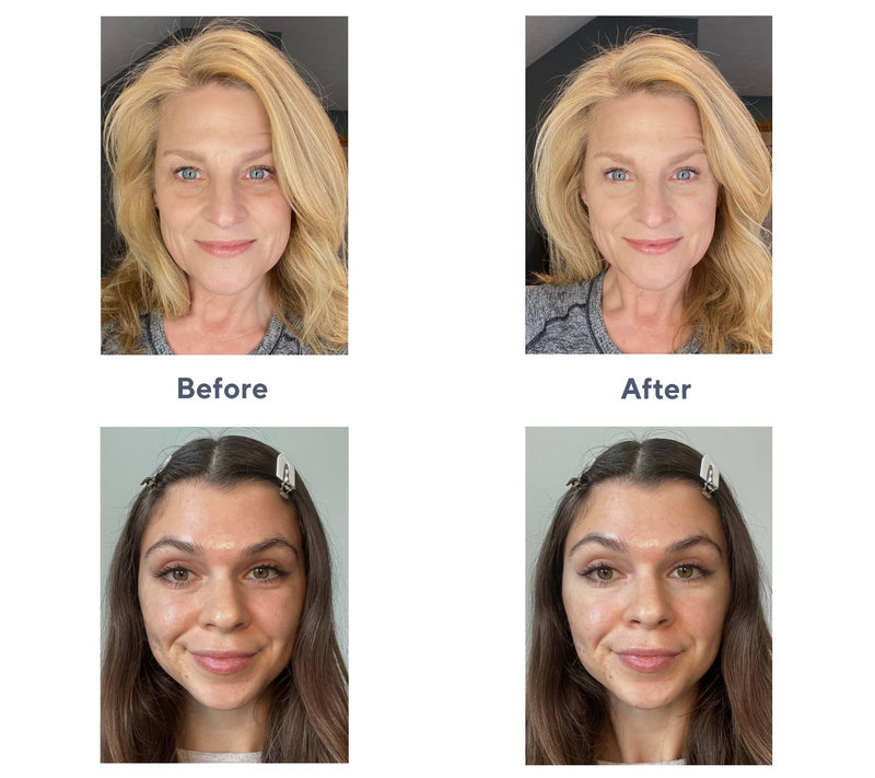 Doll 10 Doll Skin Genius Tinted Under Eye Treat ment — View 17