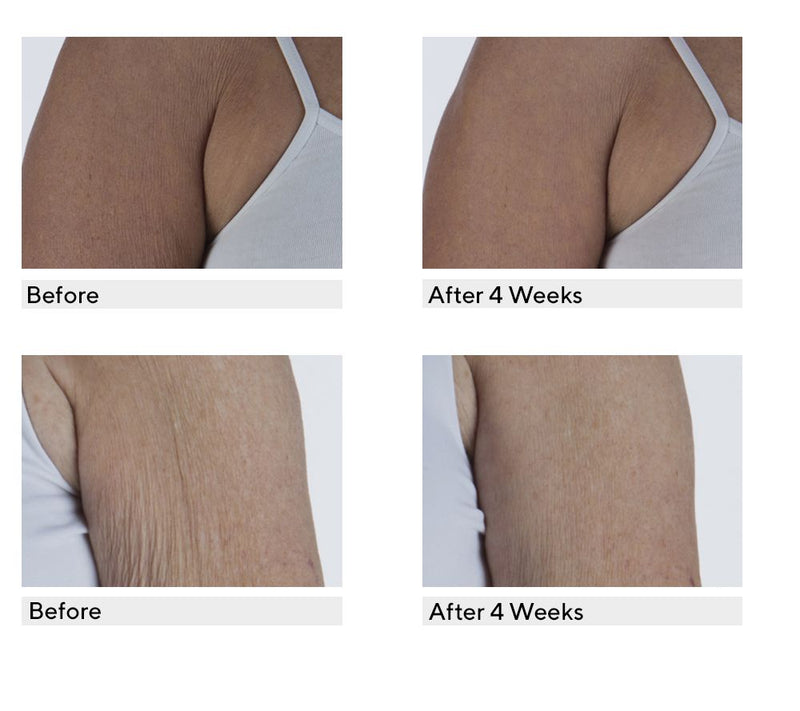 philosophy ultimate miracle worker resurfacing body serum duo — View 3