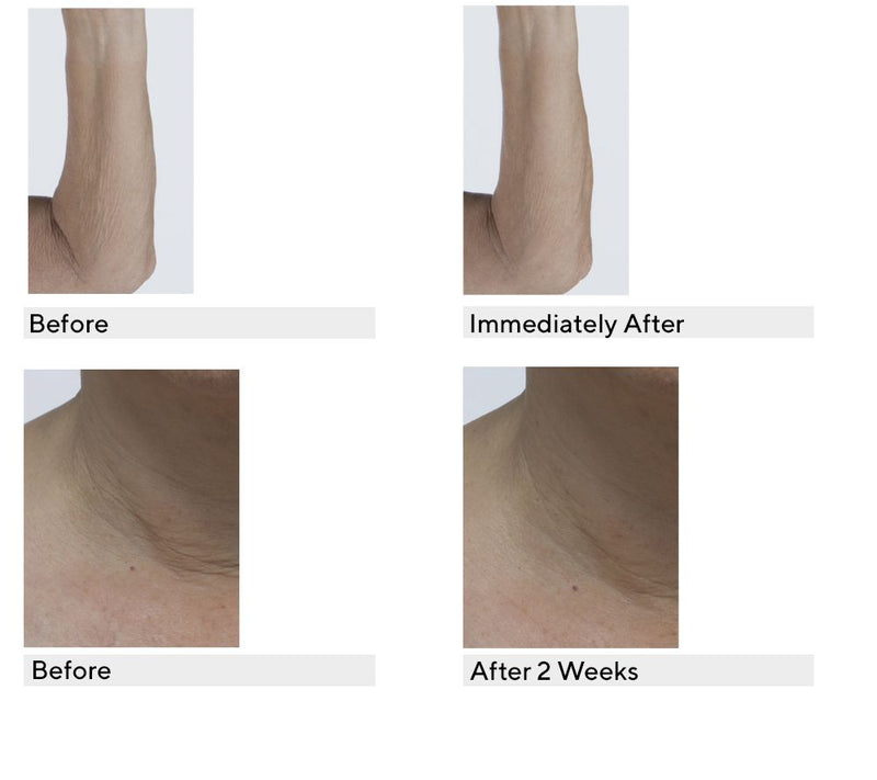 philosophy ultimate miracle worker resurfacing body serum duo — View 4